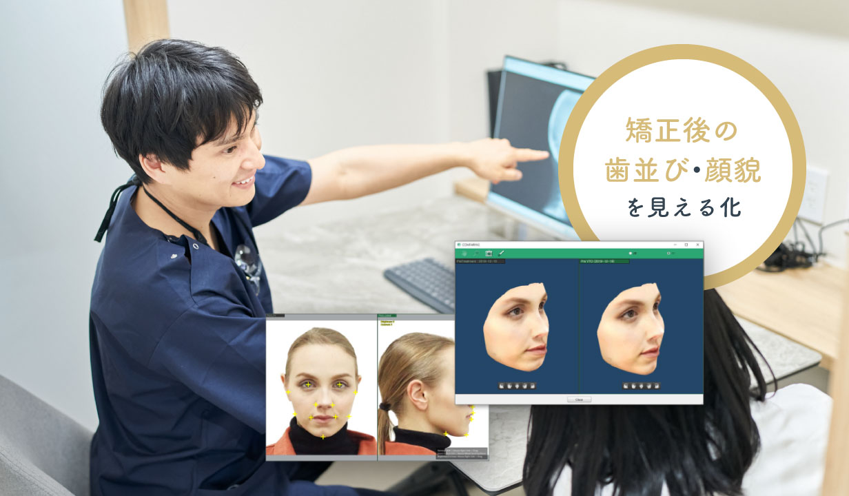 矯正分析ソフト