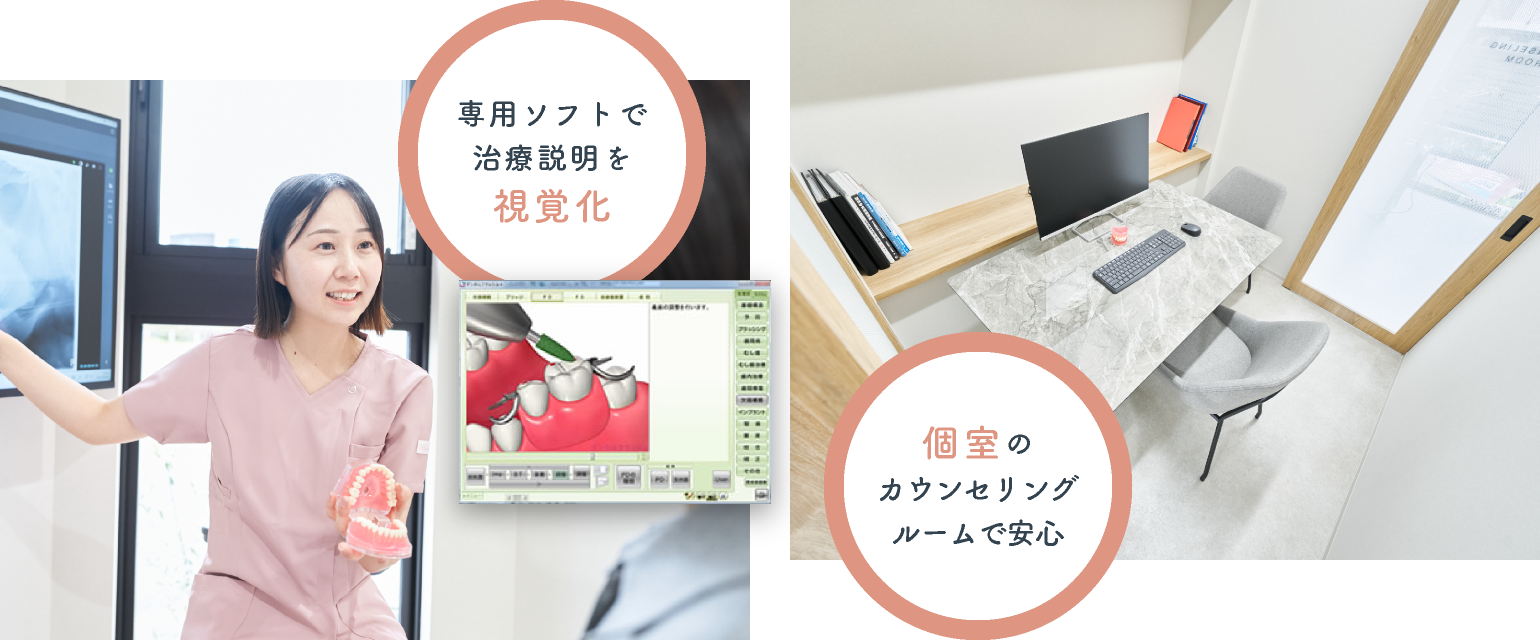 専用ソフトで治療説明を視覚化/個室のカウンセリングルームで安心