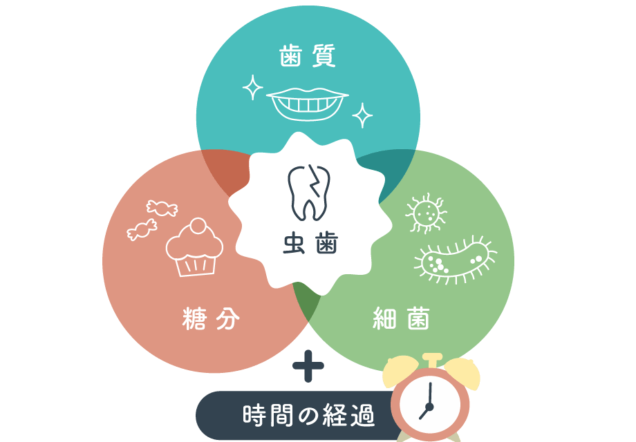 歯質・糖分・細菌のバランスと時間の関係