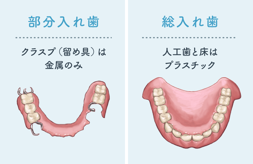 保険診療の入れ歯