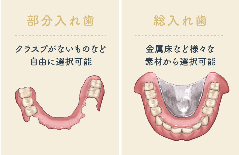 自由診療（自費診療）の入れ歯
